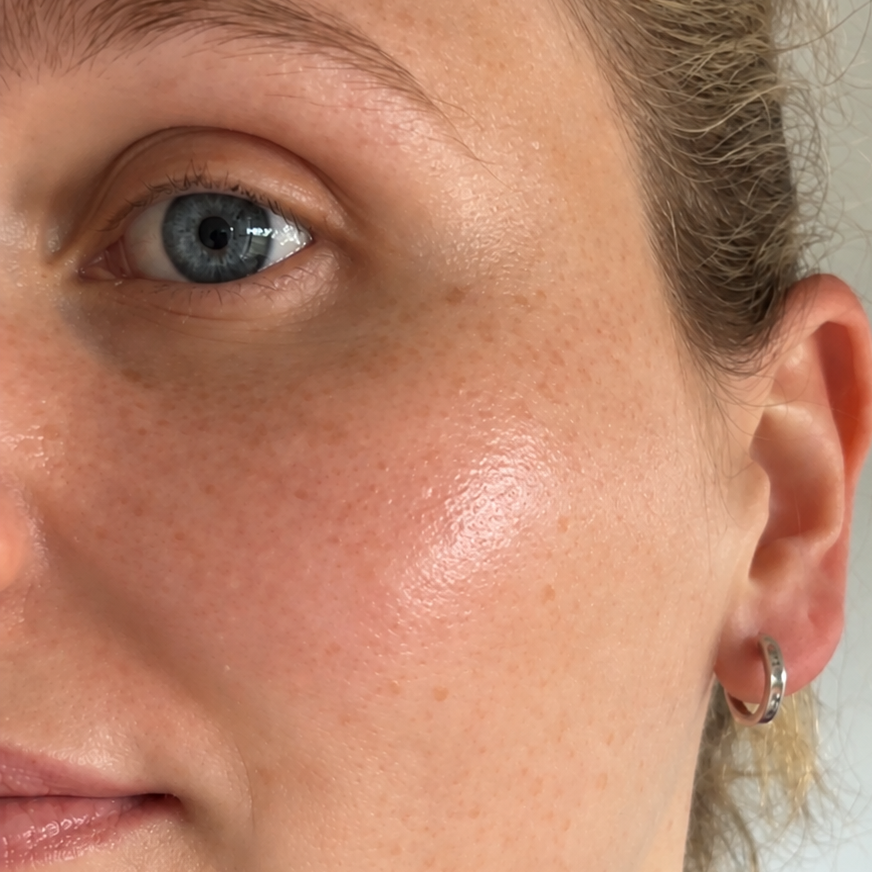Close-up of a woman with visible skin texture, freckles, and glowing, hydrated skin.